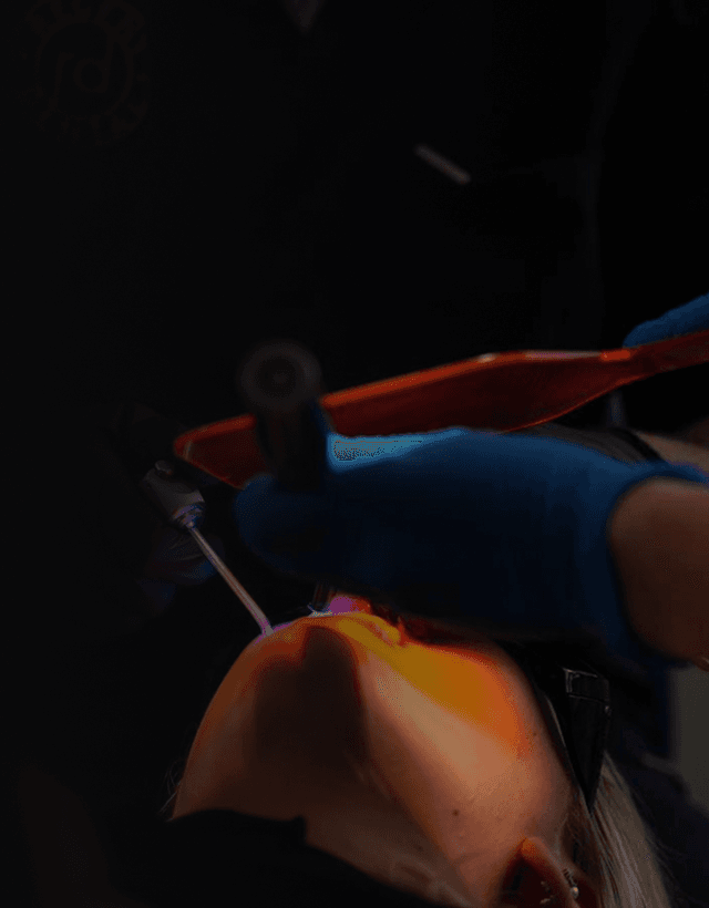 Dental professional using a curing light during a dental procedure.